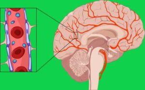 高山腦水腫發生原因之血腦屏障BBB